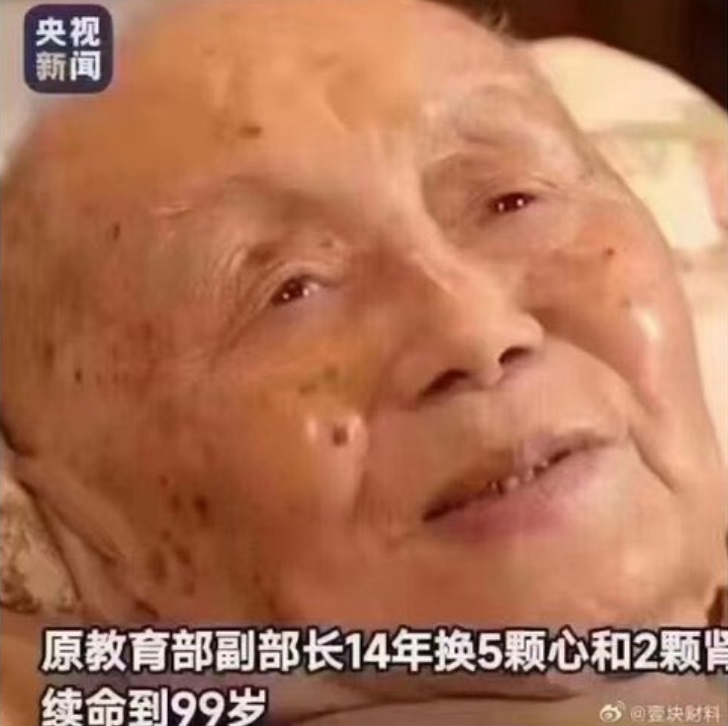 中國原教育部副部長 14 年換 5 顆心和 2 顆腎，續命到 99 歲。   圖：翻攝自央視新聞
