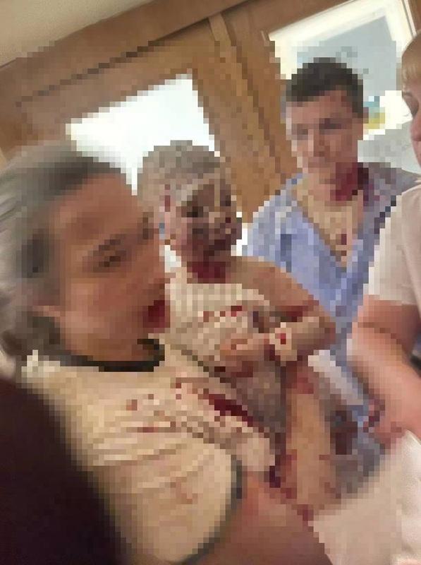 俄羅斯導彈擊中基輔的奧赫馬迪特兒童醫院。有嬰兒渾身都是血，看起來慘不忍睹。   圖：翻攝自湘女 X（前推特）帳號