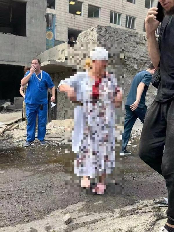 俄羅斯導彈擊中基輔的奧赫馬迪特兒童醫院。有人衣服上都是血，頭也包著繃帶。   圖：翻攝自湘女 X（前推特）帳號