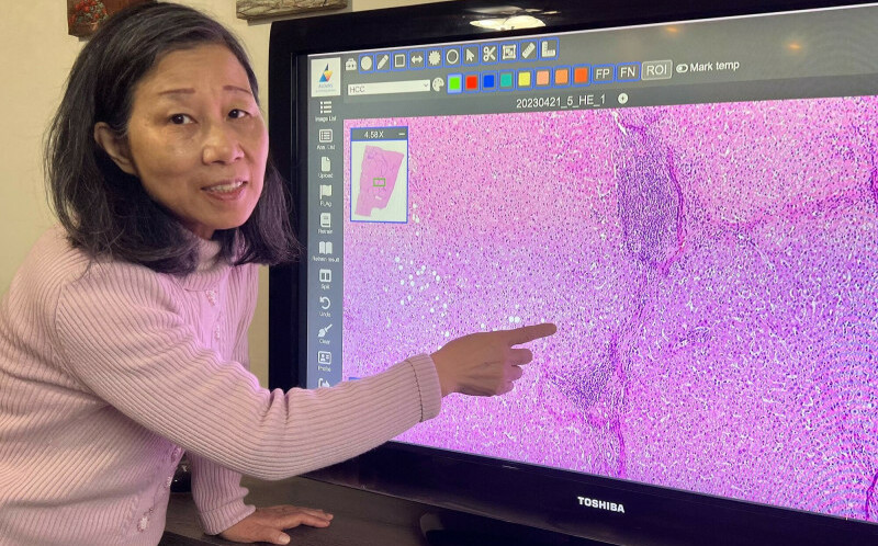 全台第一！衛福部認證AI數位病理平台  成大：今年將申請美國FDA認證