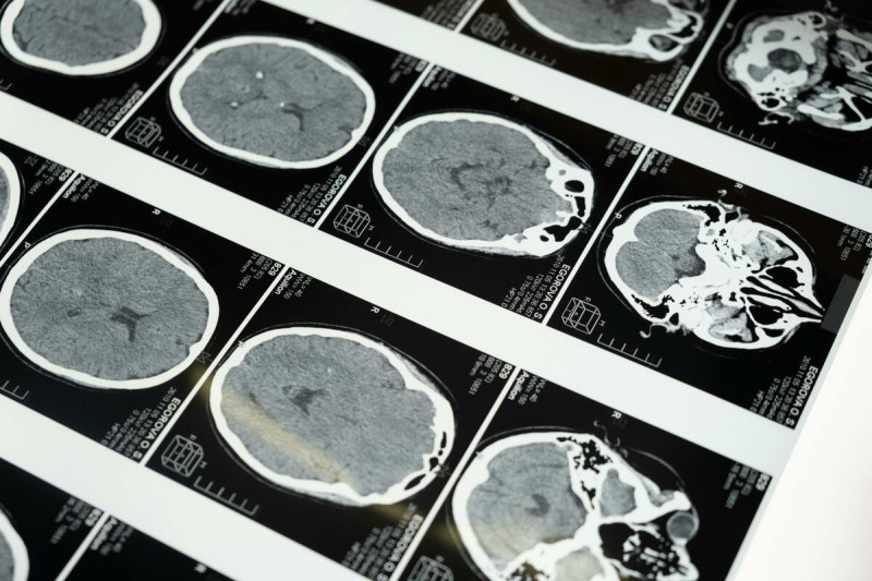 這項科學成果由美國艾倫腦科學研究所（Allen Institute for Brain Science）聯手貝勒醫學院（Baylor College of Medicine）及普林斯頓大學（Princeton University），動員 150 名科學家、歷時近十年完成，相關研究已於 4 月 9 日發表在《自然》（Nature）期刊。   圖 : 翻攝自 pexels