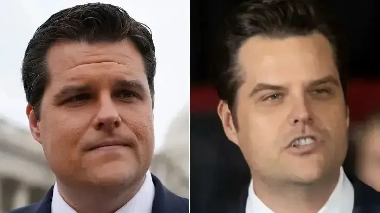 男性如眾議員馬特·蓋茨(Matt Gaetz)也傳出接受整形手術的消息。 圖:翻攝自南風窗 男性如眾議員馬特·蓋茨(Matt Gaetz)也傳出接受整形手術的消息。 圖:翻攝自南風窗