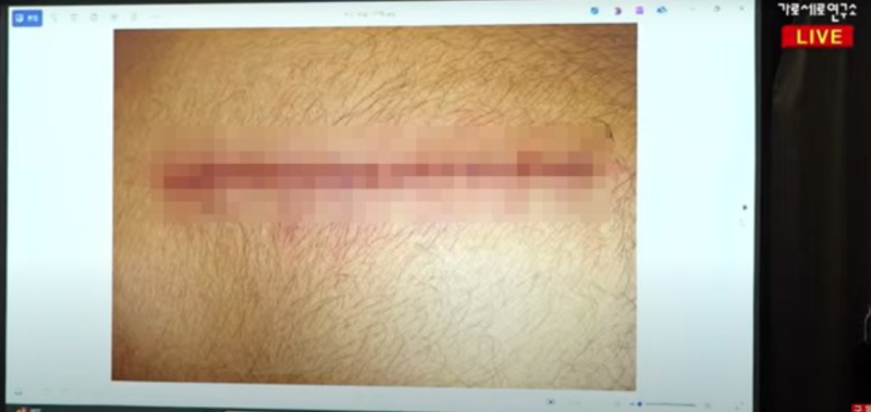 這名提供音檔的友人聲稱因為捲入此事,遭到不明人士襲擊。 圖:翻攝自橫豎研究所YT頻道