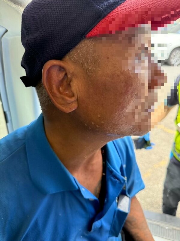苗栗縣竹南科學園區1家光電廠21日發生3名外包工人遭鹼性廢液體噴濺，導致手腳和臉部分別遭灼傷，消防局獲報立即將傷患送醫。（民眾提供）中央社記者管瑞平傳真  114年5月21日   
