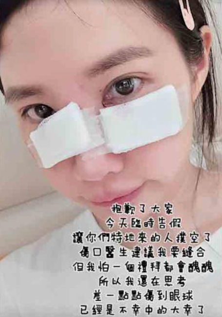 筠熹昨(22)日臉部遭愛犬咬傷，緊急向球團告假。   圖：翻攝自筠熹IG