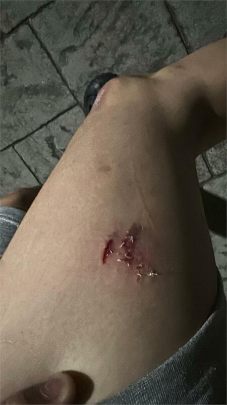 張姓男子PO出與店家對話並展示遭咬傷口。 圖:取自Threads
