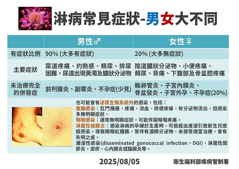 淋病症狀男女有別,男性九成有尿道灼熱、流膿等症狀,女性則有八成無症狀,輕忽恐致不孕。 圖:疾管署/提供