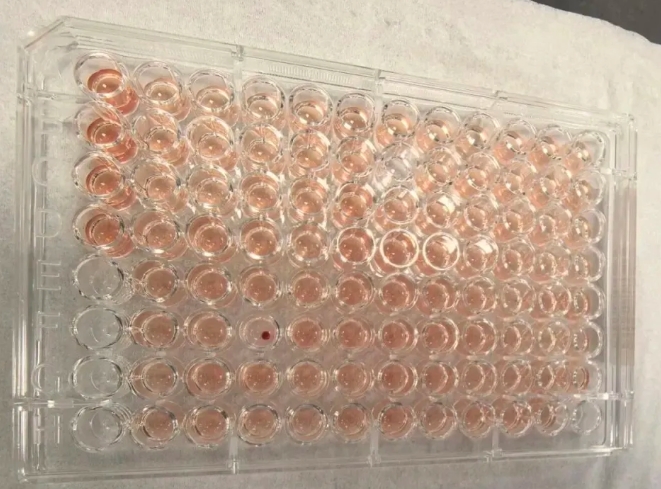 佛山市順德區中心血站表示，近日該血站檢驗科篩查出一例稀有血型 Jk(a-b-)——稀有度超「熊貓血」百倍的「鑽石血」，溶血實驗首度出現陰性結果。   圖 : 翻攝自紅網