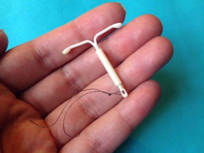 子宮內避孕器（IUD）示意圖。   圖 : 翻攝自Sarah Mirk  / Flickr