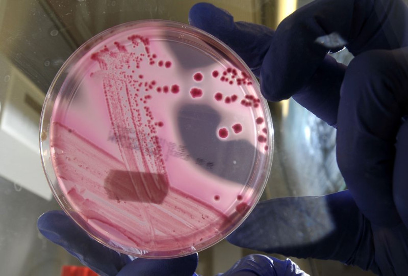 在歐洲造成18人死亡的致命大腸桿菌，疫情已擴散到美國。圖片來源：達志影像/路透社   
