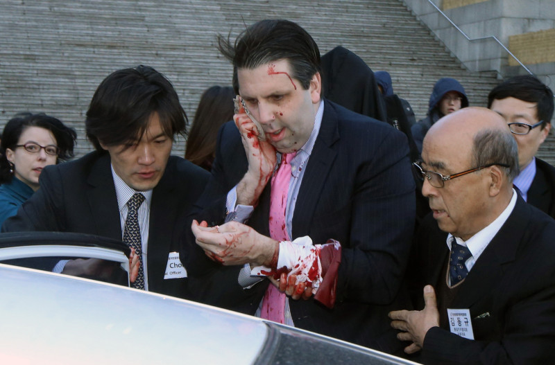 美國駐韓大使李柏特在出席活動前，遭到1名50多歲男子持刀劃傷，當場血流滿面。來源：達志影像/美聯社   