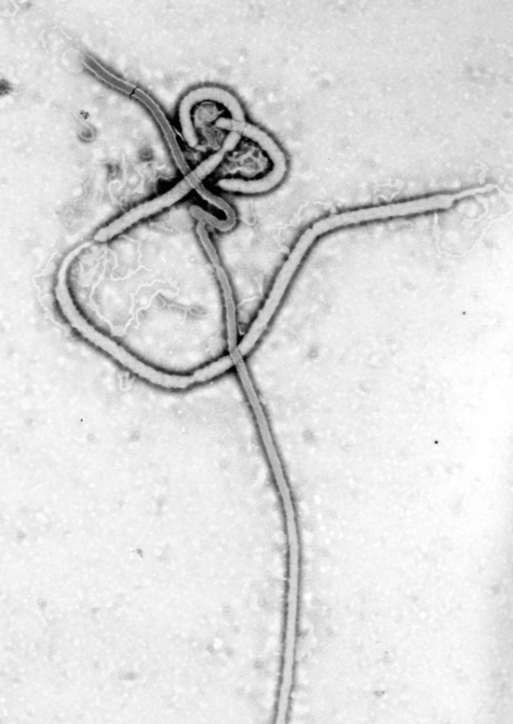 賴比瑞亞新聞部長布朗（Lewis Brown）今天說，3名感染伊波拉病毒，並接受實驗藥物ZMapp治療的非洲醫生，已有一人在賴比瑞亞首都蒙羅維亞（Monrovia）不治死亡。圖為伊波拉病毒。 圖片來源：維基共享資源公共領域。   