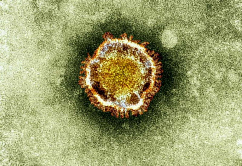 法國衛生部門於13日表示，確定第二起病例感染新型冠狀病毒(圖)，該病人與先前首位確診病人同住一病房。圖片來源：達志影像/美聯社。   