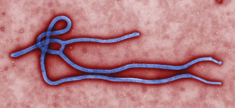 澳洲當局今天表示，一名從幾內亞抵達澳洲的少女出現高燒症狀，目前在醫院隔離，檢測是否感染伊波拉病毒。圖片來源：達志影像/路透社資料照片   