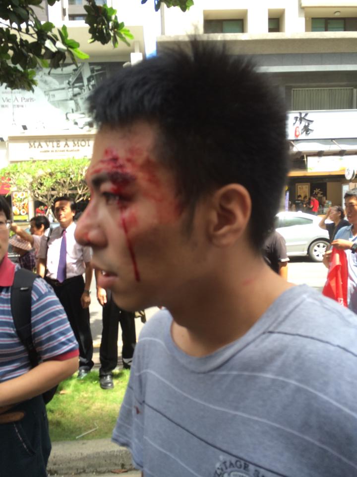 抗議民眾今(27)日在高雄抗議國台辦主任張志軍來台參訪，卻疑似被警方過肩摔至頭破血流。圖：翻攝自基進側翼臉書。   