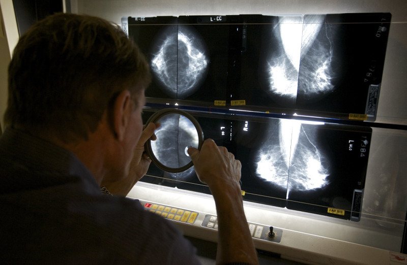 美國科學家研發出乳癌疫苗，成功防止實驗鼠得到乳癌，研究人員正在計畫人體投藥實驗。圖片來源：達志影像/美聯社。   