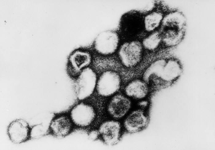 圖為穿透式電子顯微鏡下的德國麻疹病毒。圖：維基共享資源   
