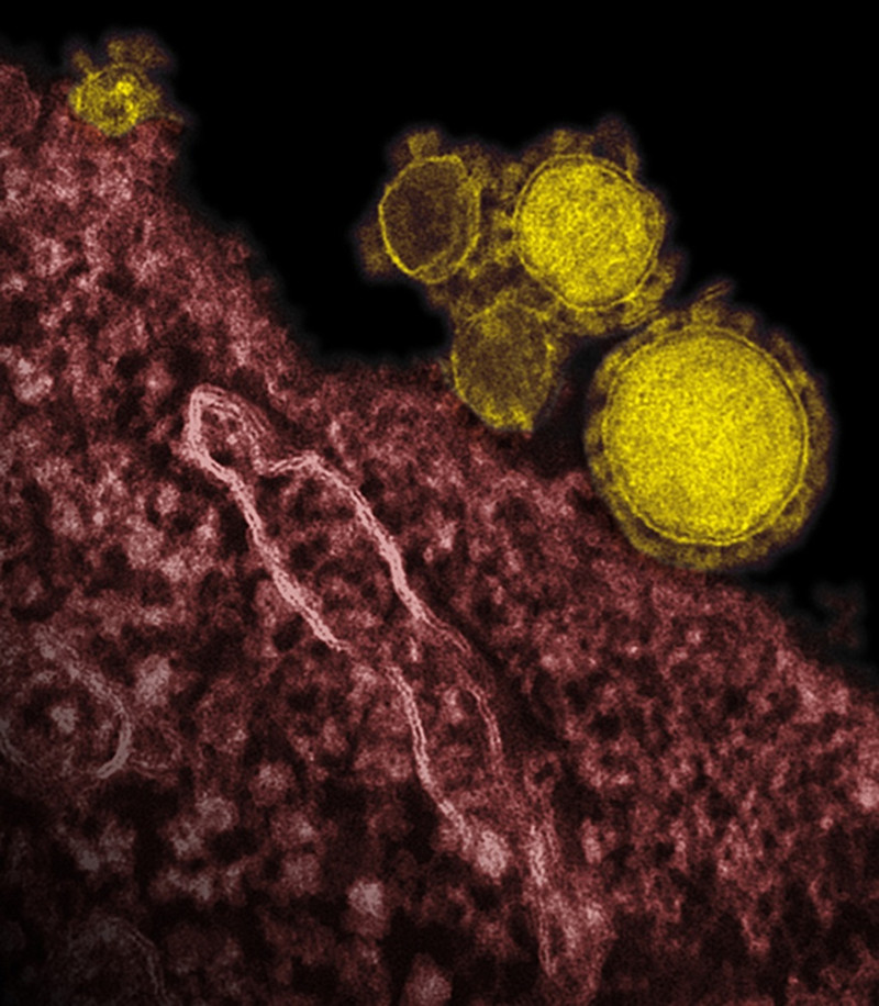 韓國保健福祉部1日發布消息，中東呼吸症候群冠狀病毒感染症（MERS-CoV）疫情持續擴大，確診病患人數再增加3人。圖片來源：達志影像/美聯社   