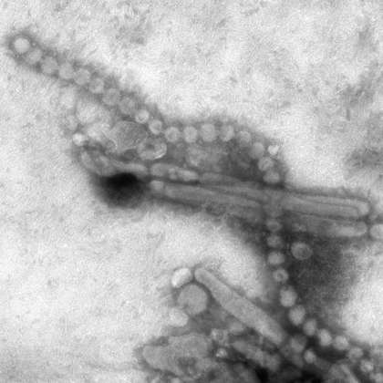 台灣今(24)日出現首例H7N9禽流感確診病例，而10年前的今天，2003年4月24日，和平醫院則因為爆發SARS（重急性呼吸道症候群）院內感染遭到封院。圖為H7N9病毒。圖片來源：達志影像/美聯社   