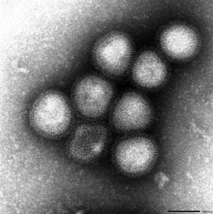 日本國立感染症研究所從中國取得的H7N9禽流感病毒的電子顯微鏡攝影。圖片來源：WHO。   