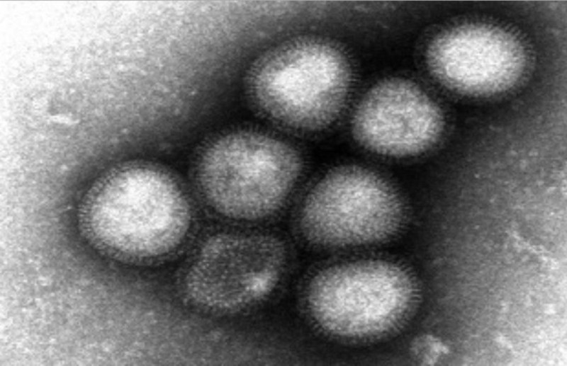 世界衛生組織（WHO）今天表示，中國大陸又有7人在過去1週罹患H7N9致命病株禽流感。圖為日本培養出來的H7N9病毒株。圖片來源：WHO官方網站。   