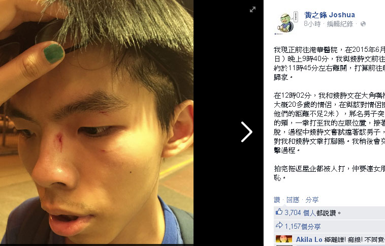 黃之鋒自己在臉書上交代遇襲過程，左眼附近受傷。圖：翻攝黃之鋒臉書   