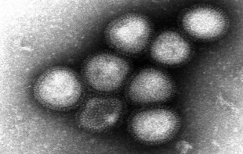 H7N9型禽流感立刻發生世界性大流行的可能性很低。圖為H7N9型病毒株。圖片來源：世界衛生組織(WHO)引用自日本國立感染症研究所(NIID)。   
