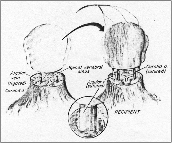 1971年懷特博士對猴子頭顱進行移植手術的手繪圖。圖：翻攝自網路。   