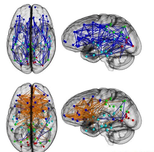 科學家所繪出的神經網路體圖顯示，男性的腦神經連接走向由前至後（上圖），而女性的腦神經則在左右腦之間迂迴的連接（下圖），是影響兩性行為差異的因素。圖：翻攝網路   