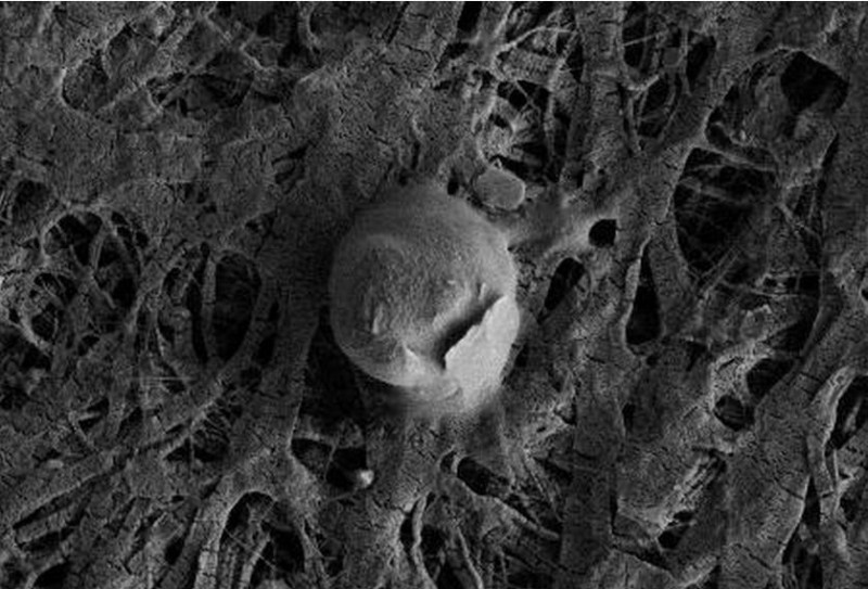 圖為南極冰層下的惠蘭斯湖(Whillans)所發現的球形細菌的電子顯微鏡照片。圖片來源：美國路易西安那州立大學研究團隊提供。   